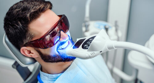 Male getting teeth whitened