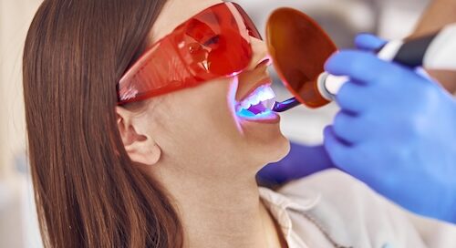 Woman Having Dental Work Done