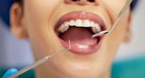Woman Getting Oral Check Up