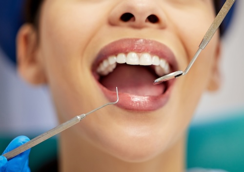 Woman Getting Oral Check Up