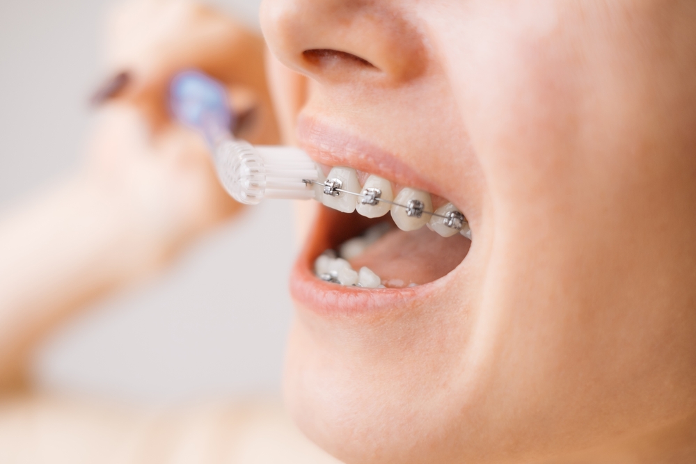 woman brushing her teeth