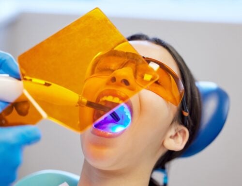 How Long Do Dental Fillings Last? What Patients Should Expect
