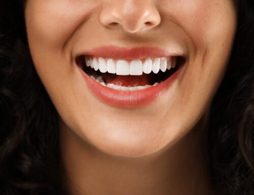 Does Teeth Whitening Work? What Works and What to Avoid