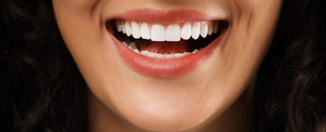 whitened teeth