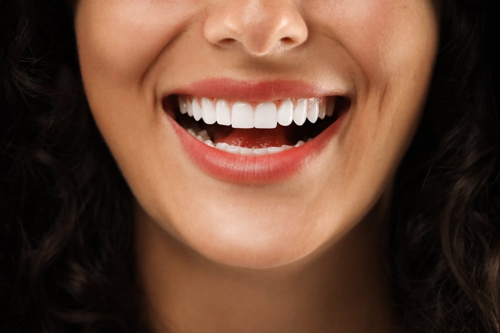 whitened teeth