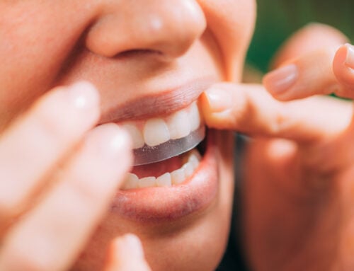 How to Whiten Teeth at Home Safely (and What to Avoid)