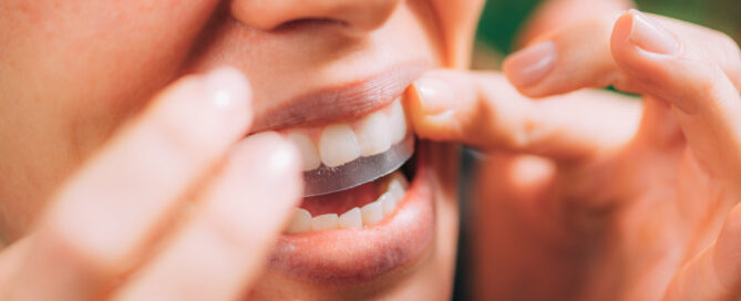 How to Whiten Teeth at Home Safely - image of someone whitening their teeth