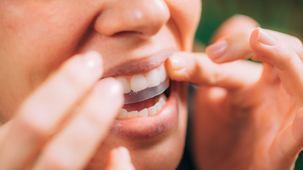 How to Whiten Teeth at Home Safely - image of someone whitening their teeth