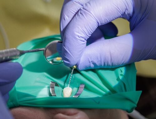 Root Canal Recovery: What to Expect After Treatment