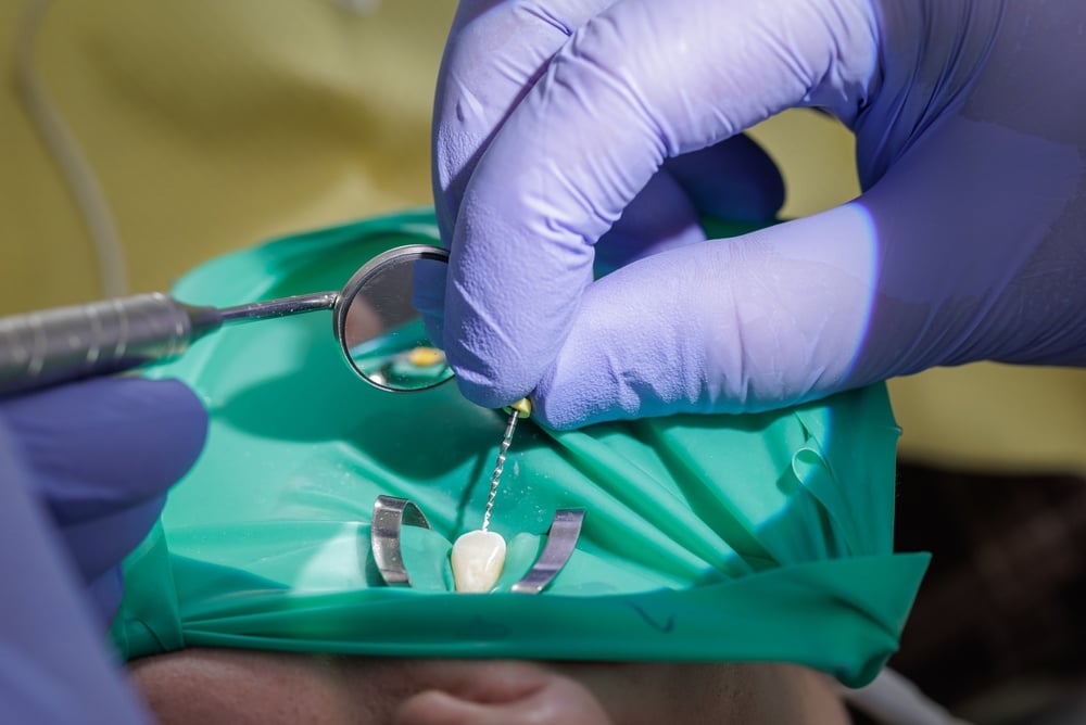 Root canal recovery - patient getting a root canal procedure